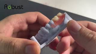 What is the best flexible denture [upl. by Alhan680]