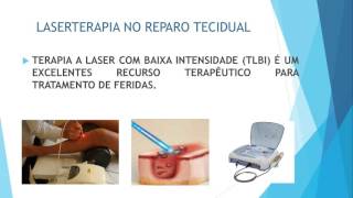 LASERTERAPIA NO REPARO TECIDUAL JOELITA e MARIANA [upl. by Auric]