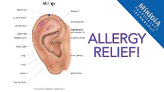 Auriculotherapy for Allergy Relief DIY Allergy Protocol [upl. by Snoddy255]