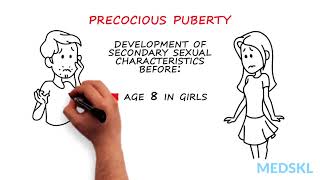 Pediatrics – Abnormal Pubertal Development By Paola Luca MD [upl. by Reahard]