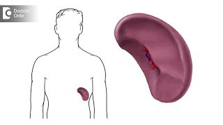 What causes a spleen to enlarge Can you a shrink an enlarged spleen  Dr Lorance Peter [upl. by Turk]