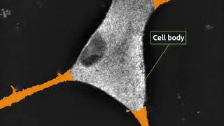 hCN2 cells 20 days after neurite growth stimulation media addition Nanolive labelfree [upl. by Lesiram972]