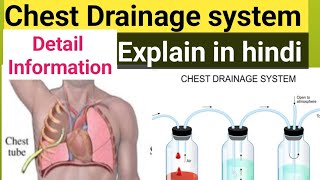 chest Drainage system explain in hindi water seal drainage system youtubeviralvideoyoutuber [upl. by Menedez200]