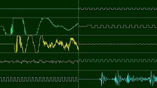 Cerror  Je Zus Oscilloscope View [upl. by Aileduab729]