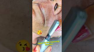 Upper Lip Hair Remove  Machine facialhairremoval upperlip [upl. by Nolyak]