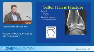 Growth Plate Injuries of the Ankle [upl. by Fawcett626]