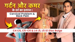 FullVideo👉C4 C5 C5C6 amp L4 L5 L5 S1 Disc Bulge  गर्दन और कमर के दर्द का इलाज Cervical amp Back Pain [upl. by Eelaras70]