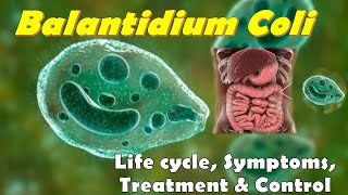 Balantidium coli Morphology Life cycle Symptoms Treatment and Control Methods [upl. by Tallula]