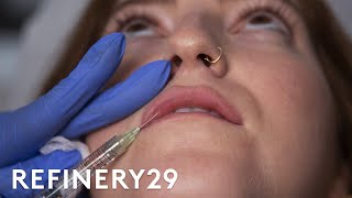 I Got Lip Filler Injections For The First Time  Macro Beauty  Refinery29 [upl. by Guido]