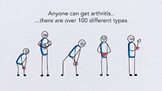 Arthritis GP animation [upl. by Rawdon696]