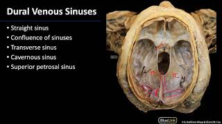 Cranial Cavity and Brain  Dural Venous Sinuses [upl. by Perlie]