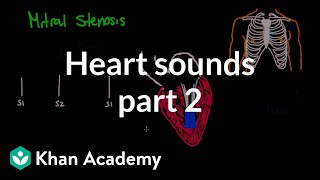 Systolic murmurs diastolic murmurs and extra heart sounds  Part 2  NCLEXRN  Khan Academy [upl. by Siram]