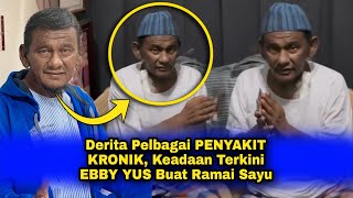 Derita Pelbagai PENYAKIT KRONIK Keadaan Terkini EBBY YUS Buat Ramai Sayu [upl. by Saxena540]