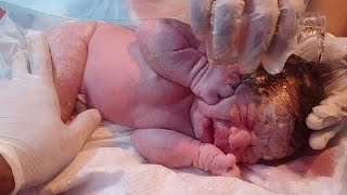 New born baby very very cute came with lot of vernix my camera man rotate the phone but baby clean❣️ [upl. by Trixie]