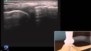 How To Ultrasound Exam of the Medial Collateral Ligament 3D Video [upl. by Vlad]