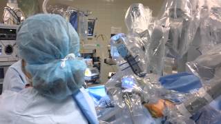 daVinci® SingleSite® Gallbladder Surgery  Middlesex Hospital [upl. by Euqirdor]