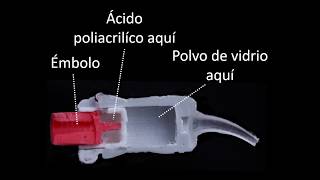 Dentro de una capsula de ionomero de vidrio [upl. by Anihpled696]