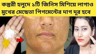 রাতে এটামাখো ১দিনে ত্বক ফর্সা উজ্জ্বল দাগহীন হবেমুখের কালো দাগ দূর করার উপায়mesta dur korar upay [upl. by Yrkcaz]