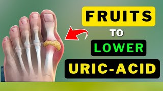 BEST FRUITS TO LOWER URIC ACID NATURALLY [upl. by Atiruam]