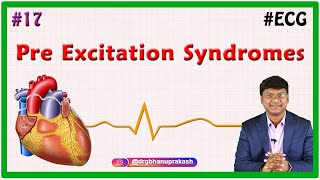 17 Pre Excitation Syndromes  LownGanongLevine syndrome amp WolffParkinsonWhite WPW pattern [upl. by Pamella591]