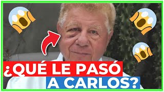 😱 CARLOS SUFRIÓ un ACCIDENTE ALAZRAKI REVELA qué le PASÓ en su OJO quotME SALIÓ MUCHA SANGREquot [upl. by Ajaj178]