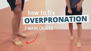 Pronated Feet and How to Fix 3 Different Causes of OVERPRONATION [upl. by Oicirtap]