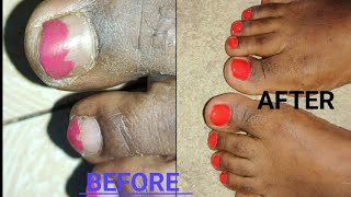 STEP BY STEP DIY PEDICURE WITH NAIL POLISH  save dollars  time [upl. by Pish298]