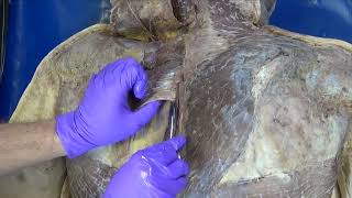 From Grant’s Dissection Video Collection Superficial Muscles of the Back [upl. by Erleena]