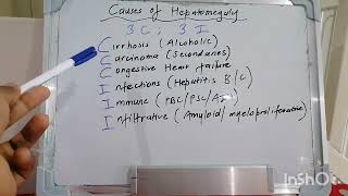 Mnemonic 57  Causes of Hepatomegaly [upl. by Anahsak]