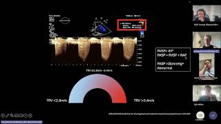 Role of Echo in Pulmonary Hypertension in the critically unwell [upl. by Plume]