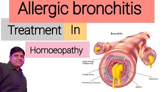 Homeopathic medicine for Allergic Bronchitis  Allergic Bronchitis Treatment in Homeopathy  Hindi [upl. by Argent]