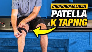 Relieve Knee Pain FAST Chondromalacia Patella K Taping [upl. by Keheley]