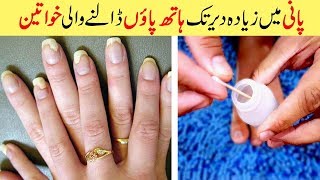 Get Rid of Toenails Fungus Natural Treatment amp Cure Simple Home Remedies Urdu Hindi [upl. by Landmeier]