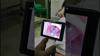 Video laryngoscope intubation [upl. by Scuram]