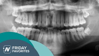 Friday Favorite How to Treat Periodontitis with Diet [upl. by Braasch]