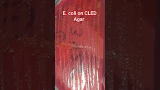 E coli Colony Morphology on CLED Agar of Urine Culture [upl. by Cirilla]