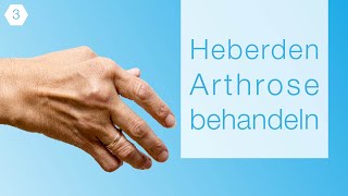 3 Heberden Arthrose Behandeln Erfahrungsbericht 2018 [upl. by Sorac]