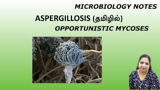 Aspergillosis  Opportunistic mycoses  Fungal infection  Dr Blessy  Tamil  Microbiology notes [upl. by Annahtur]