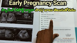 Early Pregnancy Scan  How To Read Pregnancy Scan Report  Pregnancy Scan  Pregnancy Journey [upl. by Philan]