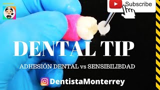 ⏩FILTROS de Café ☕️ DentalTip 👅 ADHESIÓN SENSIBILIDAD DENTAL [upl. by Nomar]