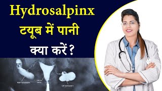 Hydrosalpinx  टयूब में पानी  Pregnancy नहीं होने का मुख्य कारण  जानिए इसका कारण और उपचार [upl. by Lait]