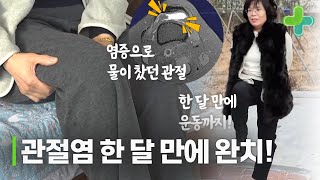 제대로 구부리지도 못했던 퇴행성 관절염 한 달 만에 완치 [upl. by Stonwin]