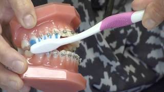 Comment brosser les dents avec des broches [upl. by Niwdla]