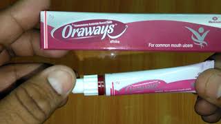 Oraways Buccal Paste review मुंह के छाले अलसर के लक्षण कारण उपचार [upl. by Anetsirhc]