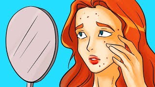 10 Miti Sull’Acne A Cui Fare Attenzione [upl. by Mendes]