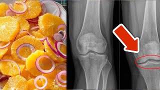 8 einfache Wege um Knie Knorpel und Bänder zu stärken🤯Super einfach💥 [upl. by Aerdnek447]