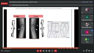 CLASE 2  TRAUMATOLOGIA  SEMIOLOGIA OSTEOARTICULAR [upl. by Caia481]