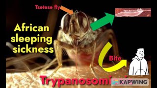 Trypanosomiasis I African sleeping sickness I Trypanosoma brucei gambiense amp rhodesiense I [upl. by Aneeras]