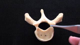 Typical Vertebra  Spinal column  Anatomy [upl. by Ardnohsal961]