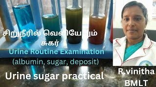 Urine Routine examination Urine sugar practical in Tamil [upl. by Ennoryt697]